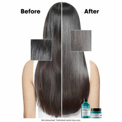L’Oréal Professionnel Scalp Advanced Anti-Oiliness Dermo-Purifier Shampoo 300ml | For Oily Scalps | Purifies the Scalp Deeply with 3% AHA | For Men & Women L’Oréal Professionnel Scalp Advanced Anti-Oiliness Dermo-Purifier Shampoo 300ml | For Oily Scalps | Purifies the Scalp Deeply with 3% AHA | For Men & Women