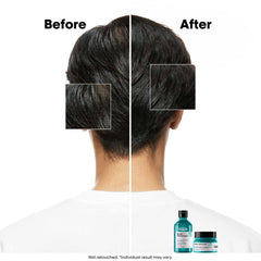 L’Oréal Professionnel Scalp Advanced Anti-Oiliness Dermo-Purifier Shampoo 300ml | For Oily Scalps | Purifies the Scalp Deeply with 3% AHA | For Men & Women L’Oréal Professionnel Scalp Advanced Anti-Oiliness Dermo-Purifier Shampoo 300ml | For Oily Scalps | Purifies the Scalp Deeply with 3% AHA | For Men & Women
