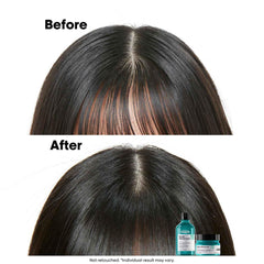L’Oréal Professionnel Scalp Advanced Anti-Oiliness Dermo-Purifier Shampoo 300ml | For Oily Scalps | Purifies the Scalp Deeply with 3% AHA | For Men & Women L’Oréal Professionnel Scalp Advanced Anti-Oiliness Dermo-Purifier Shampoo 300ml | For Oily Scalps | Purifies the Scalp Deeply with 3% AHA | For Men & Women