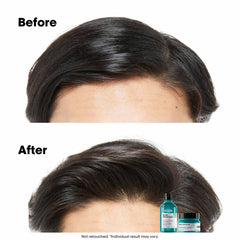 L’Oréal Professionnel Scalp Advanced Anti-Oiliness Dermo-Purifier Shampoo 300ml | For Oily Scalps | Purifies the Scalp Deeply with 3% AHA | For Men & Women L’Oréal Professionnel Scalp Advanced Anti-Oiliness Dermo-Purifier Shampoo 300ml | For Oily Scalps | Purifies the Scalp Deeply with 3% AHA | For Men & Women