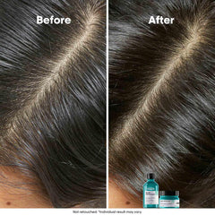 L’Oréal Professionnel Scalp Advanced Anti-Oiliness Dermo-Purifier Shampoo 300ml | For Oily Scalps | Purifies the Scalp Deeply with 3% AHA | For Men & Women L’Oréal Professionnel Scalp Advanced Anti-Oiliness Dermo-Purifier Shampoo 300ml | For Oily Scalps | Purifies the Scalp Deeply with 3% AHA | For Men & Women