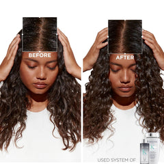 KERASTASE Symbiose Antidandruff Hair and Scalp Serum, 90ml | For Dandruff-Prone Hair & Scalp | Soothes & Hydrates Scalp | Formulated With Salicylic Acid KERASTASE Symbiose Antidandruff Hair and Scalp Serum, 90ml | For Dandruff-Prone Hair & Scalp | Soothes & Hydrates Scalp | Formulated With Salicylic Acid