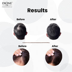 Dione UK Biotin Hair Growth serum for All Hair Types, 50 Ml